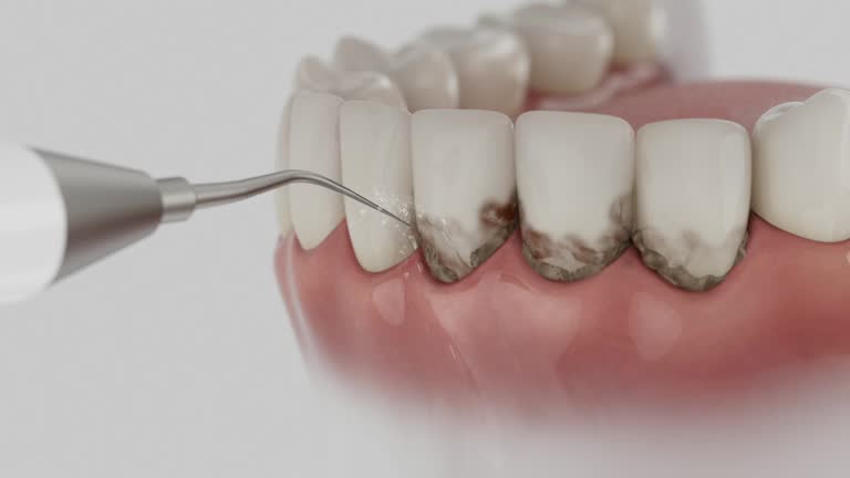 Trusted Dental Implants service in Paris, TX - Dentist Open Now